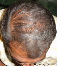 Hair After 7 months